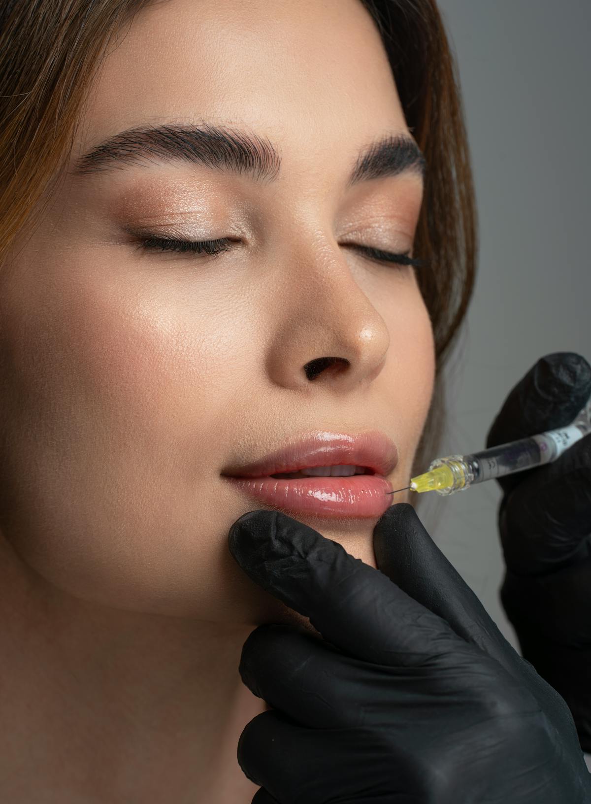 Dermal fillers consultation