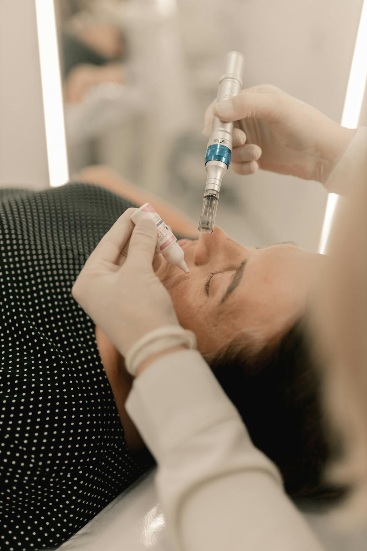 Microneedling treatment