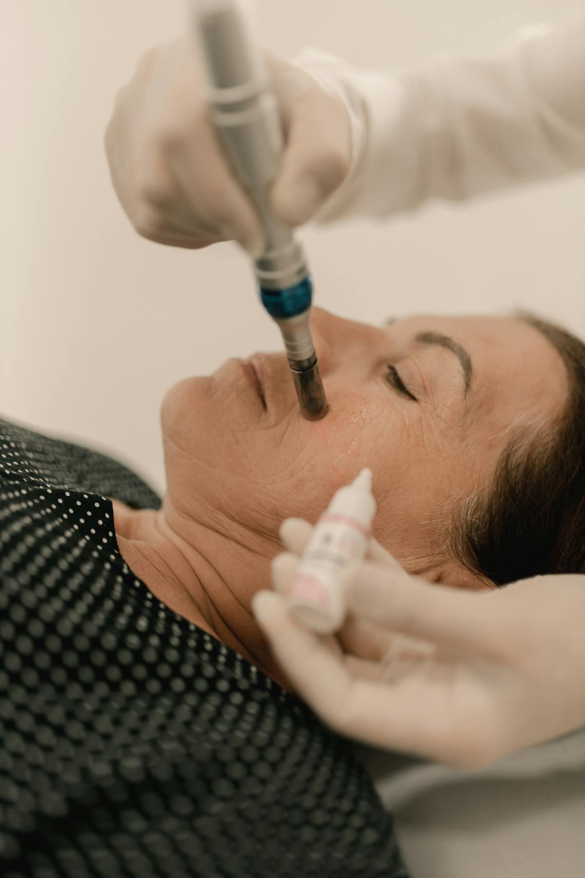 Skin booster treatment